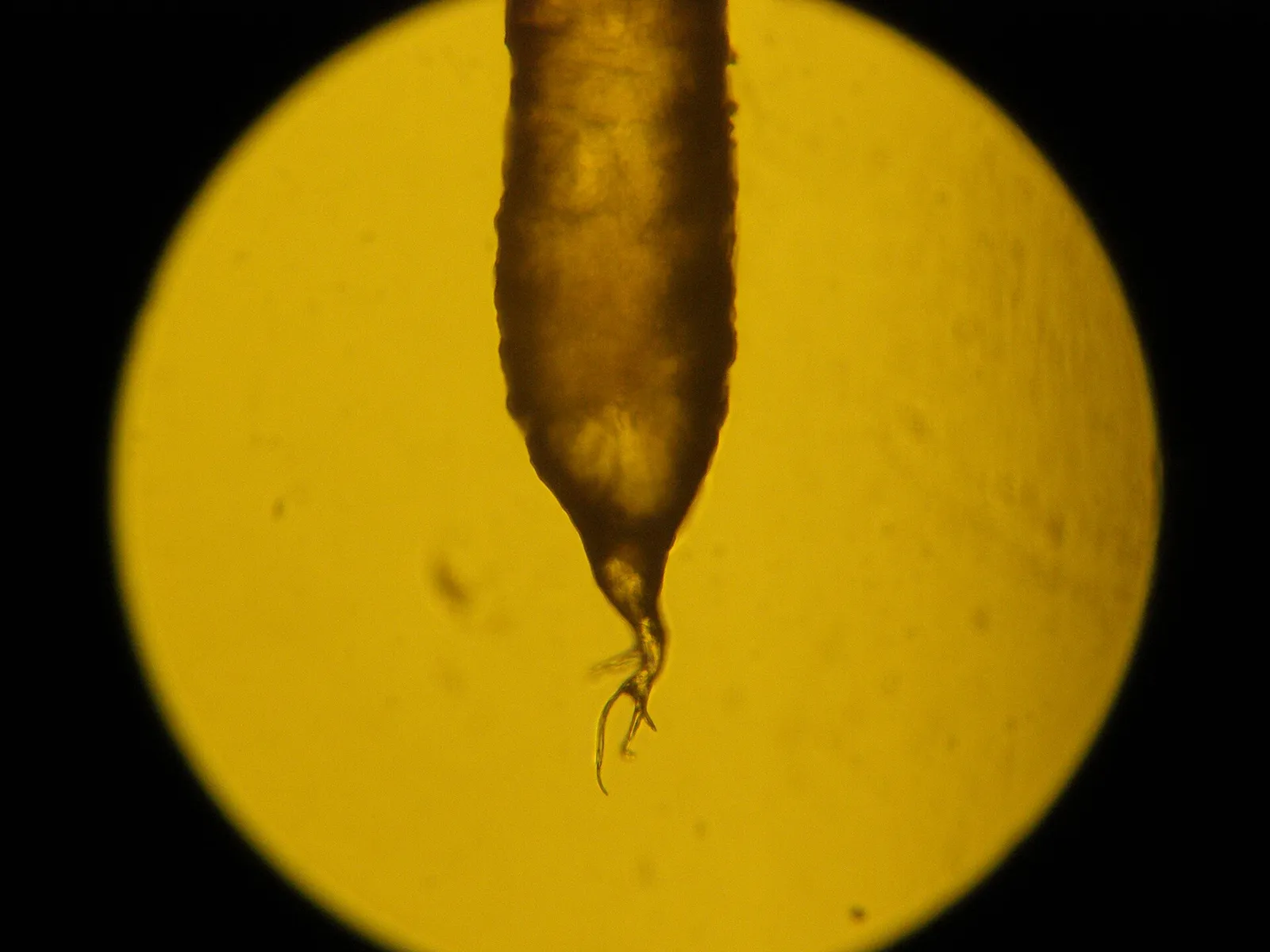 Une racine de cheveu humain observée au microscope
