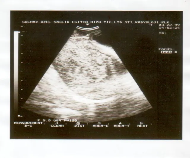 Image d'échographie médicale